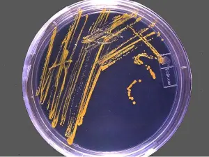 Чашка Петри с микроорганизмами, выделенными из губок в глубоких водных источниках Чашка Петри с микроорганизмами